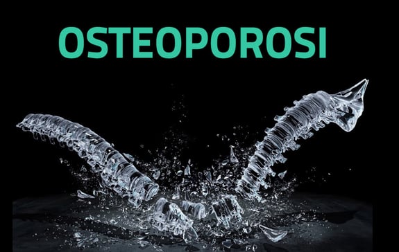 osteoporosi